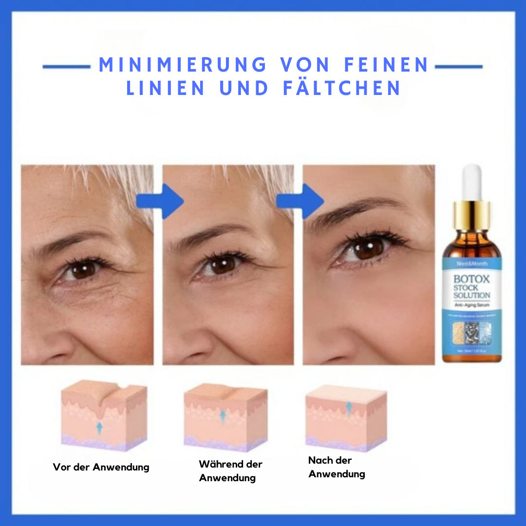 Anti-Aging Serum Botox ™ - Schönheit Serum